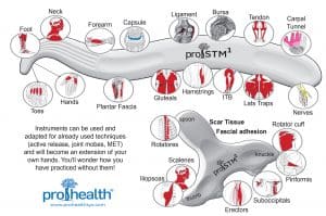 IASTM Vizniak proSTM1 proSTM2