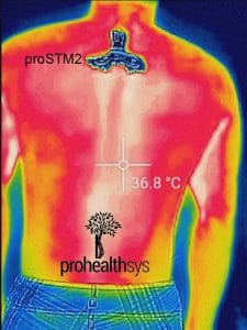 proSTM2 thermal image vizniak